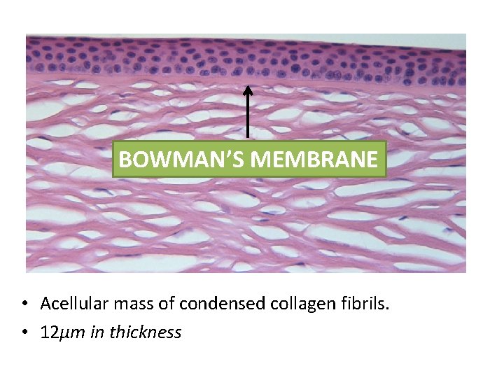 BOWMAN’S MEMBRANE • Acellular mass of condensed collagen fibrils. • 12μm in thickness 