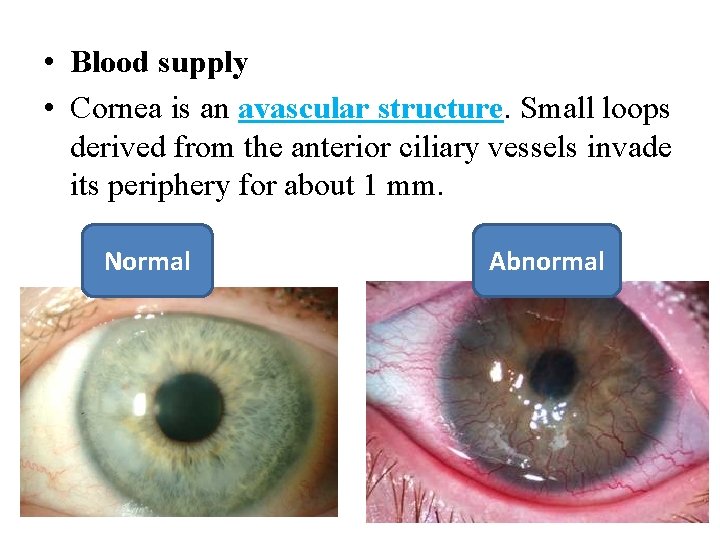  • Blood supply • Cornea is an avascular structure. Small loops derived from