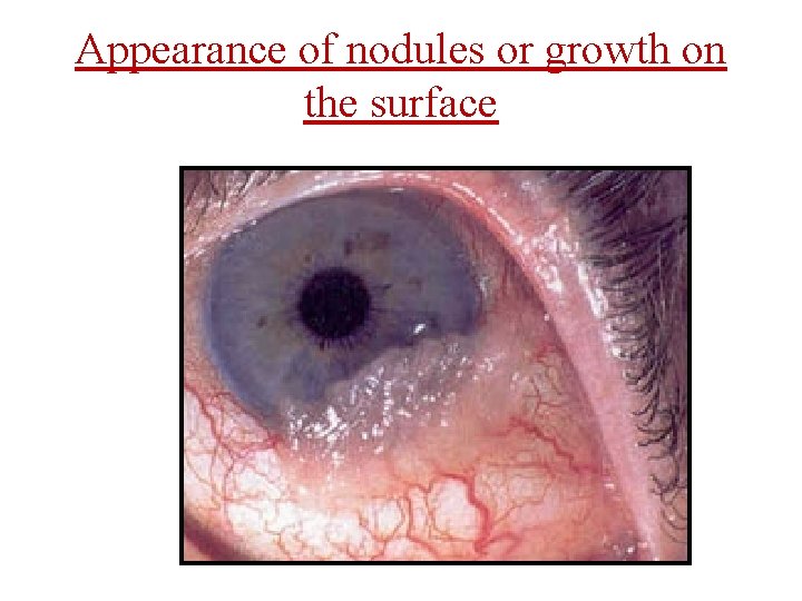 Appearance of nodules or growth on the surface 