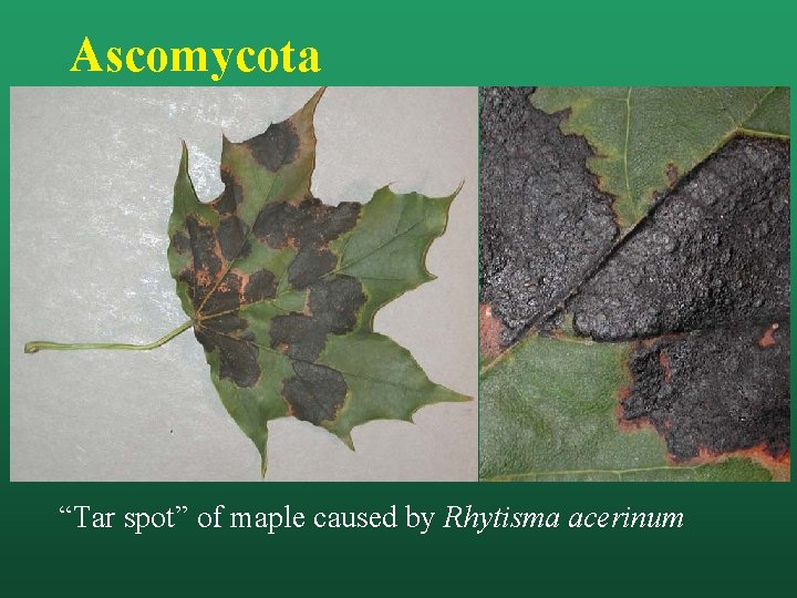 Ascomycota “Tar spot” of maple caused by Rhytisma acerinum 