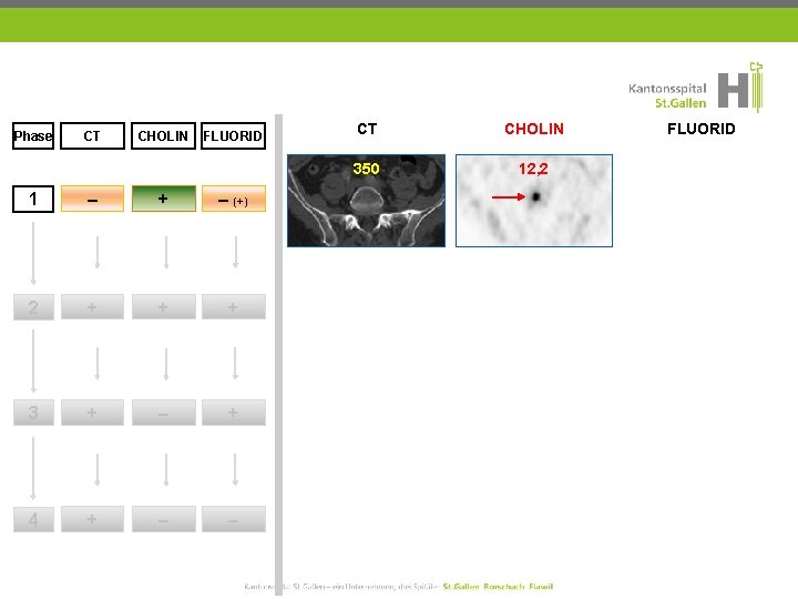 Phase CT CHOLIN FLUORID 1 – + – (+) 2 + + + 3