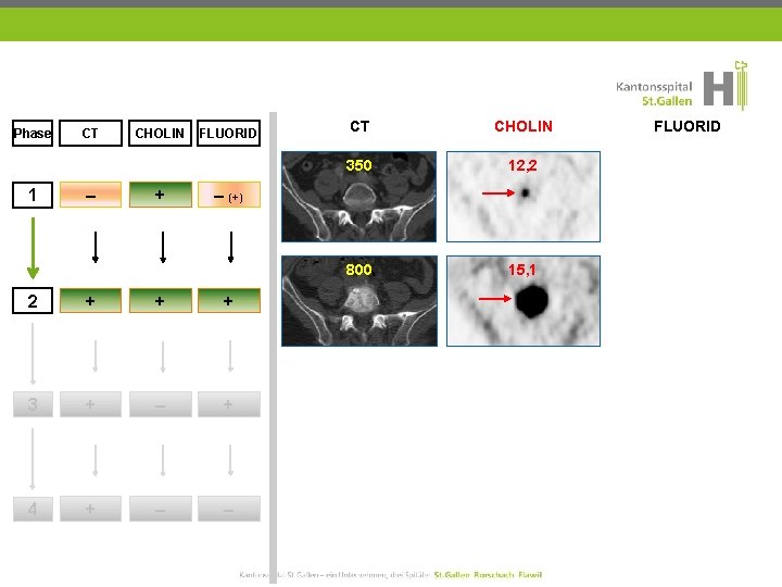 Phase 1 CT – CHOLIN + FLUORID CT CHOLIN 350 12, 2 800 15,