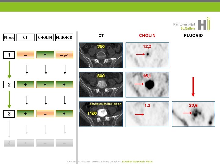 Phase 1 2 CT – + CHOLIN + + FLUORID CT CHOLIN 350 12,