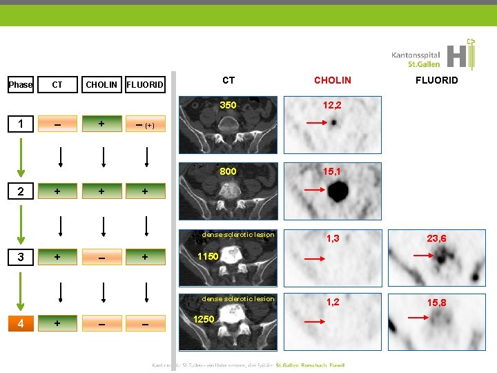 Phase 1 2 CT – + CHOLIN + + FLUORID CT CHOLIN 350 12,