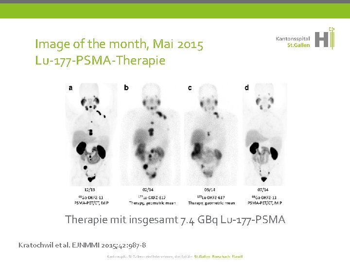 Image of the month, Mai 2015 Lu-177 -PSMA-Therapie mit insgesamt 7. 4 GBq Lu-177