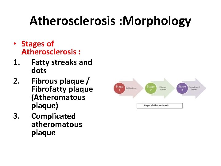 Atherosclerosis : Morphology • Stages of Atherosclerosis : 1. Fatty streaks and dots 2.