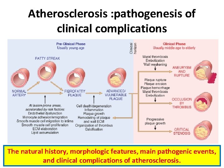 Atherosclerosis : pathogenesis of clinical complications The natural history, morphologic features, main pathogenic events,