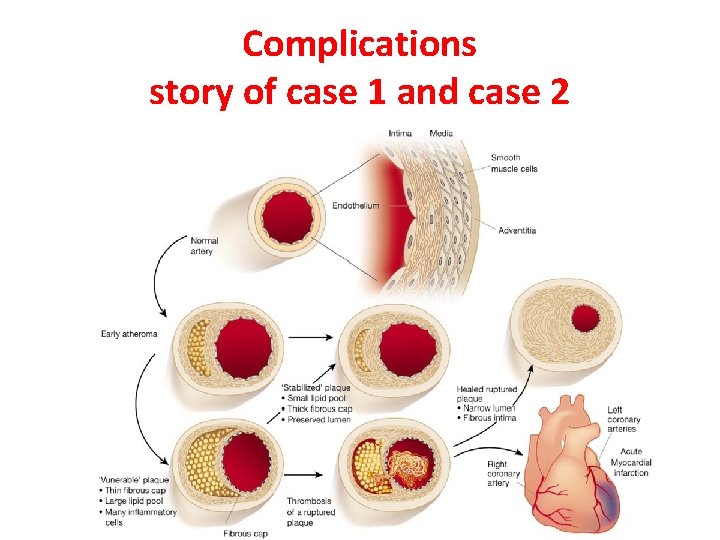 Complications story of case 1 and case 2 