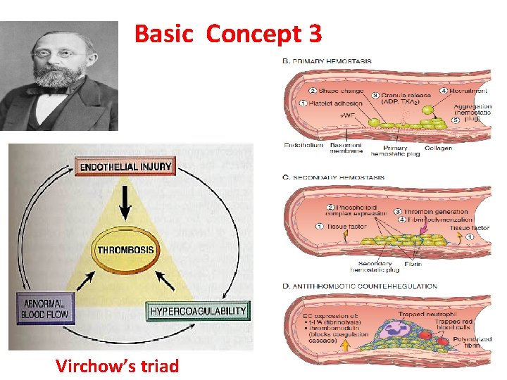 Basic Concept 3 Virchow’s triad 