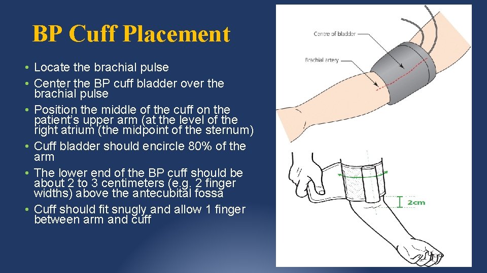 BP Cuff Placement • Locate the brachial pulse • Center the BP cuff bladder