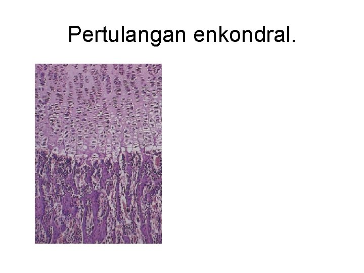 Pertulangan enkondral. 