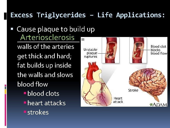 Excess Triglycerides – Life Applications: Cause plaque to build up Arteriosclerosis = _________ walls