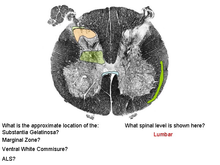 What is the approximate location of the: Substantia Gelatinosa? Marginal Zone? Ventral White Commisure?