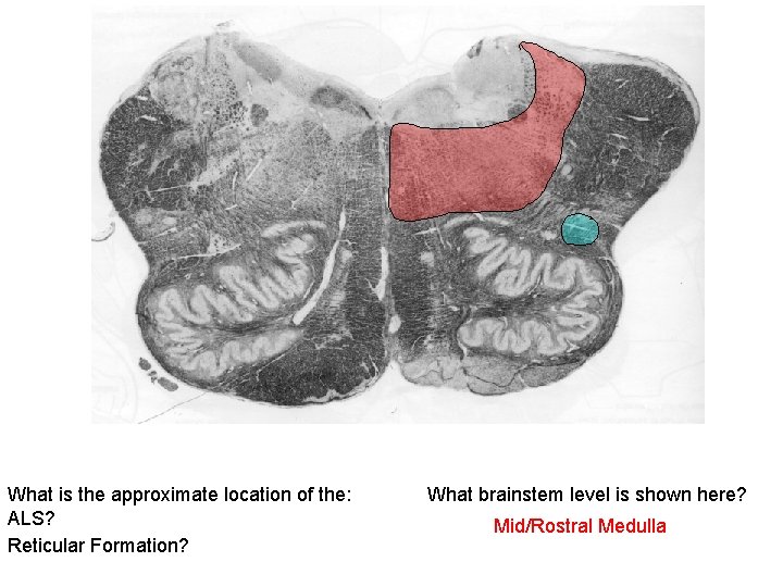 What is the approximate location of the: ALS? Reticular Formation? What brainstem level is