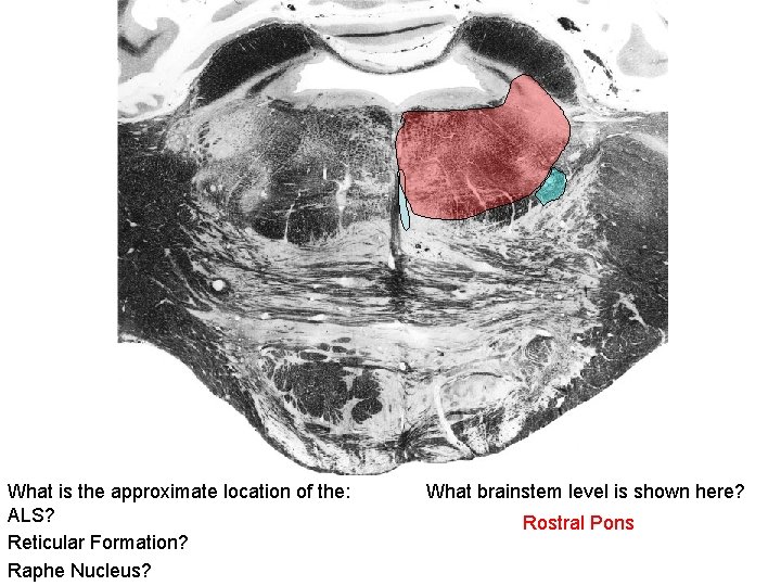 What is the approximate location of the: ALS? Reticular Formation? Raphe Nucleus? What brainstem