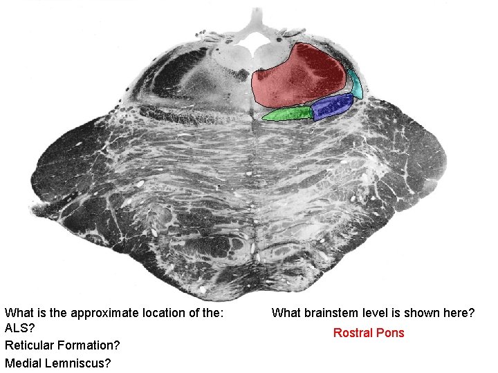 What is the approximate location of the: ALS? Reticular Formation? Medial Lemniscus? What brainstem
