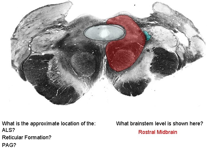 What is the approximate location of the: ALS? Reticular Formation? PAG? What brainstem level