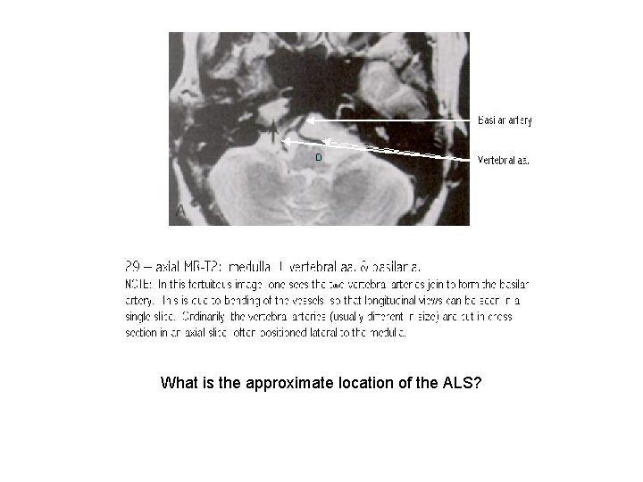 What is the approximate location of the ALS? 