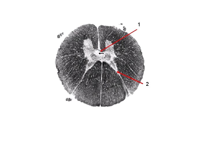 Ventral white 1 comissure Substantia 2 Gelatinosa (very white) 