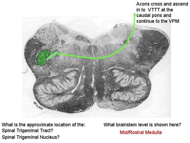 Axons cross and ascend in to VTTT at the caudal pons and continue to