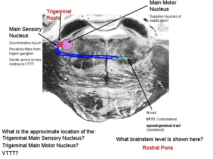 Trigeminal Roots Main Motor Nucleus Supplies muscles of mastication Main Sensory Nucleus Discriminative touch