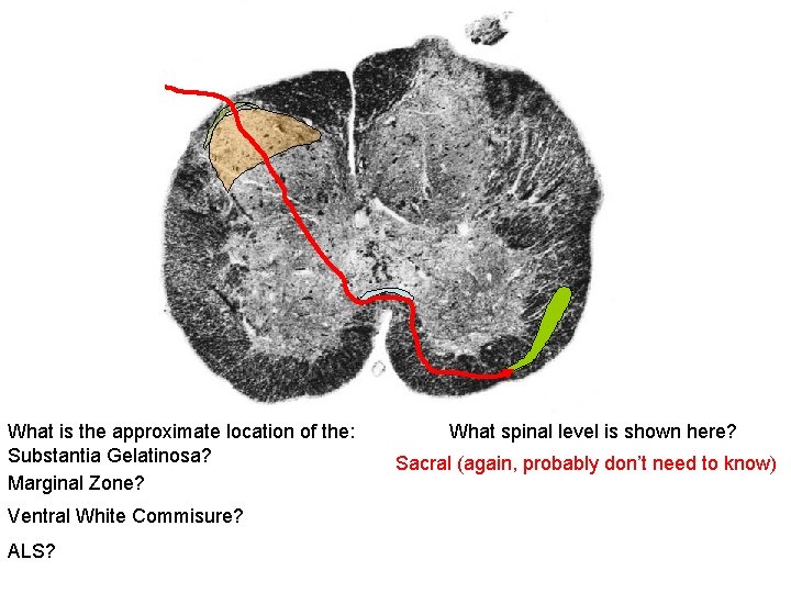 What is the approximate location of the: Substantia Gelatinosa? Marginal Zone? Ventral White Commisure?