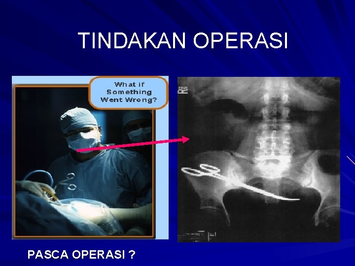 TINDAKAN OPERASI PASCA OPERASI ? 