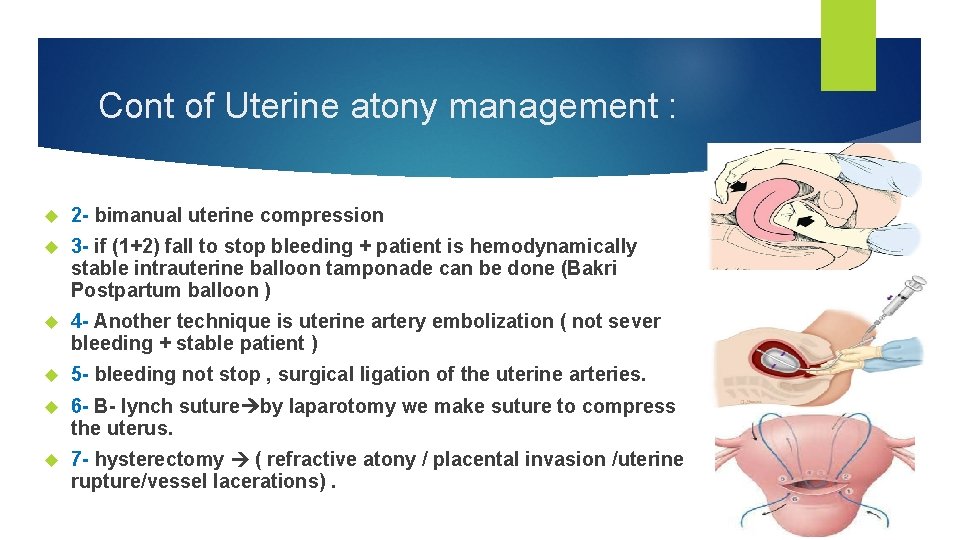 Cont of Uterine atony management : 2 - bimanual uterine compression 3 - if