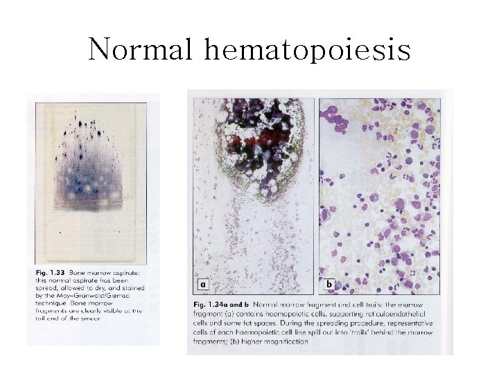 Normal hematopoiesis 