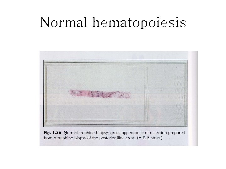 Normal hematopoiesis 