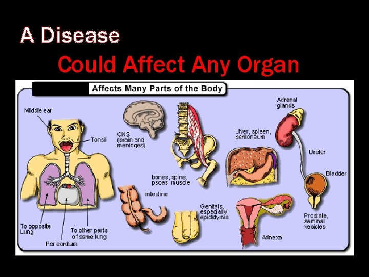 A Disease Could Affect Any Organ 