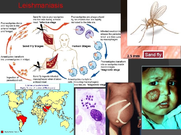 Leishmaniasis Sand fly 