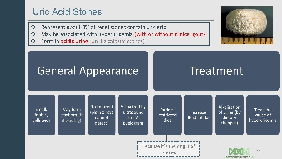 Uric Acid Stones v Represent about 8% of renal stones contain uric acid v