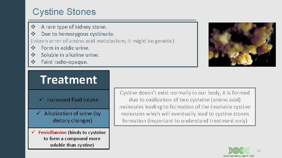 Cystine Stones v A rare type of kidney stone. v Due to homozygous cystinuria.