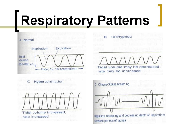 Respiratory Patterns 