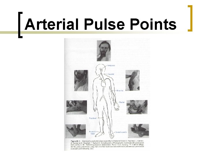 Arterial Pulse Points 