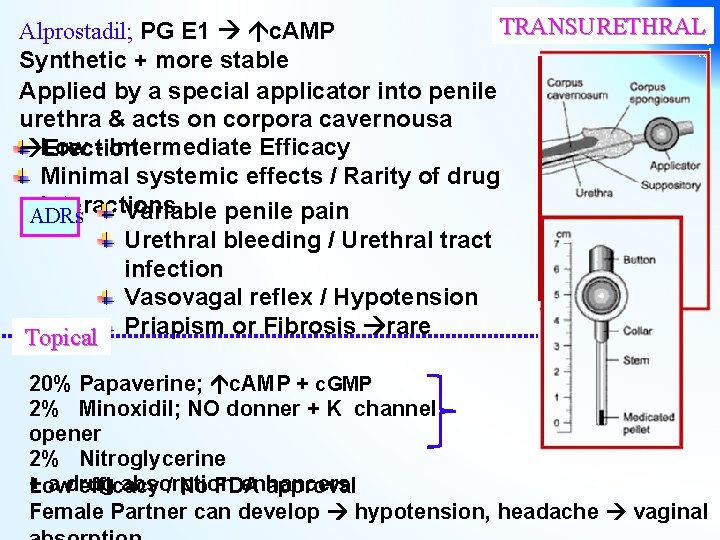 TRANSURETHRAL Alprostadil; PG E 1 c. AMP Synthetic + more stable Applied by a