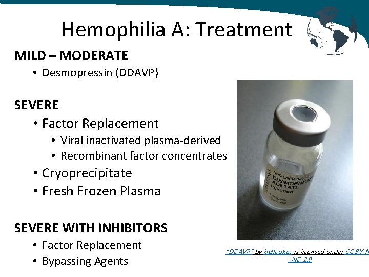 Hemophilia A: Treatment MILD – MODERATE • Desmopressin (DDAVP) SEVERE • Factor Replacement • Hemophilia A: Treatment MILD – MODERATE • Desmopressin (DDAVP) SEVERE • Factor Replacement •