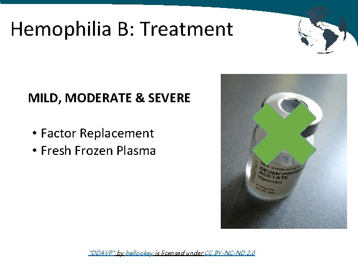 Hemophilia B: Treatment MILD, MODERATE & SEVERE • Factor Replacement • Fresh Frozen Plasma
