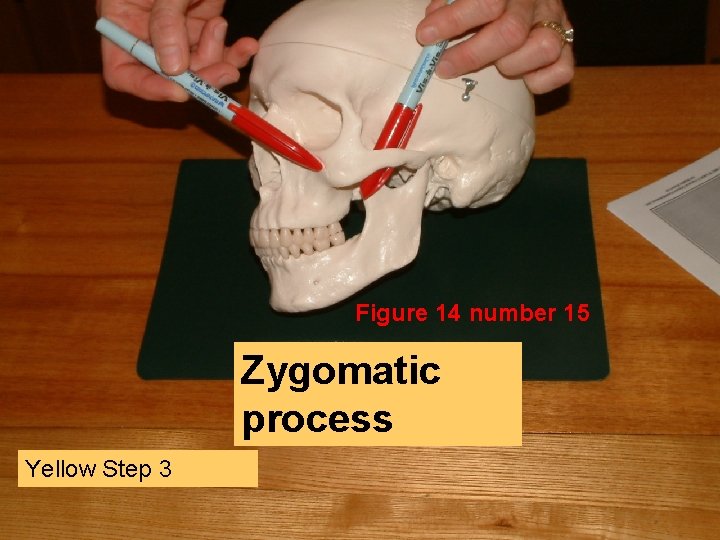 Figure 14 number 15 Zygomatic process Yellow Step 3 