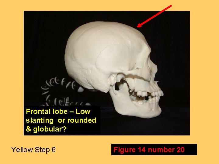 Frontal lobe – Low slanting or rounded & globular? Yellow Step 6 Figure 14