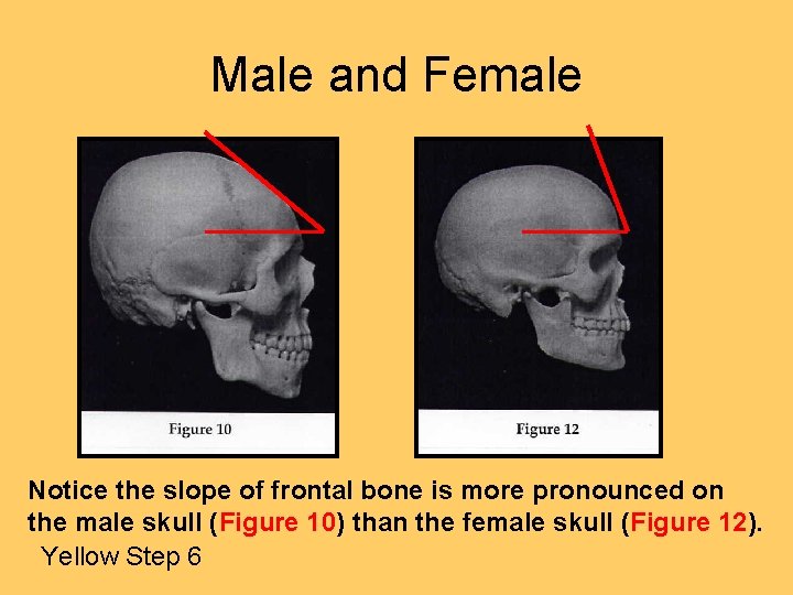 Male and Female Notice the slope of frontal bone is more pronounced on the