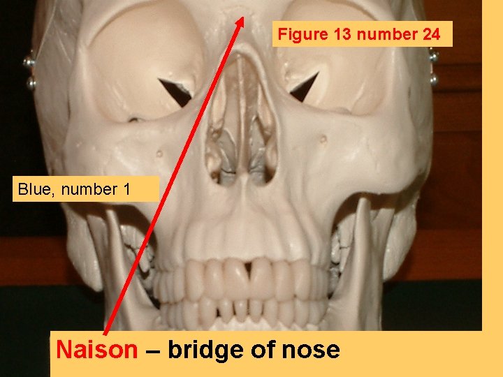 Figure 13 number 24 Blue, number 1 Naison – bridge of nose 