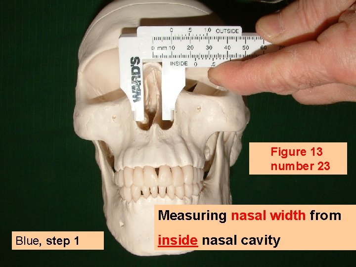 Figure 13 number 23 Measuring nasal width from Blue, step 1 inside nasal cavity