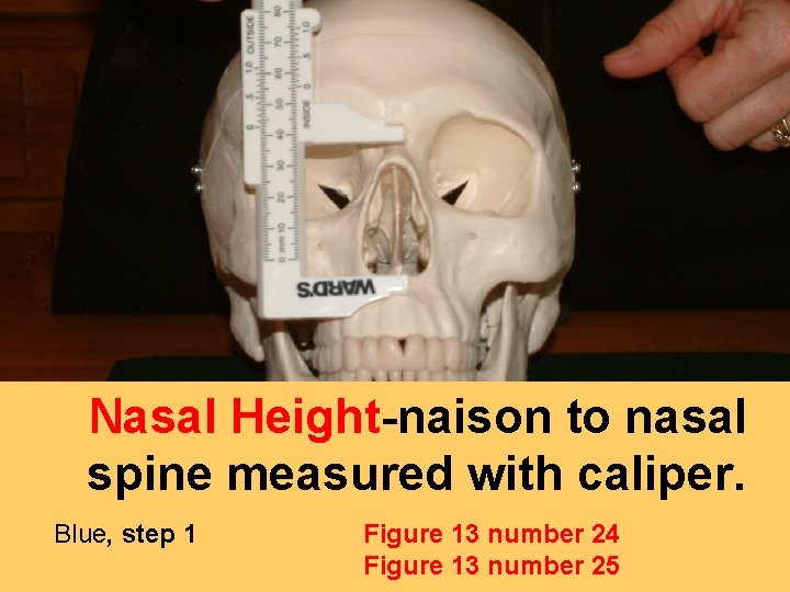  Nasal Height-naison to nasal spine measured with caliper. Blue, step 1 Figure 13