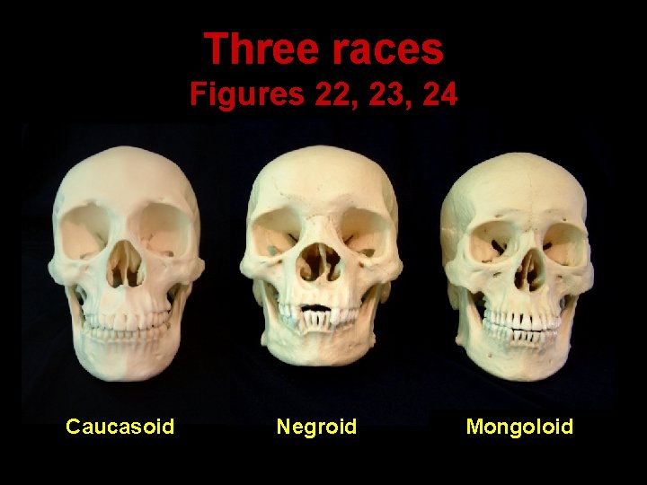 Three races Figures 22, 23, 24 Caucasoid Negroid Mongoloid 