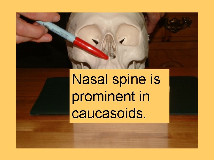 Nasal spine is prominent in caucasoids. 