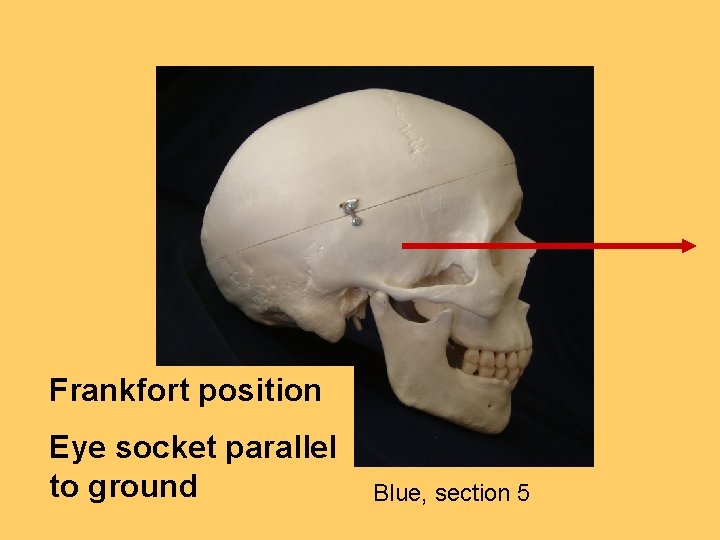 Frankfort position Eye socket parallel to ground Blue, section 5 