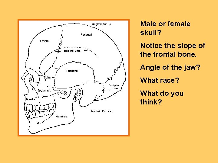 Male or female skull? Notice the slope of the frontal bone. Angle of the