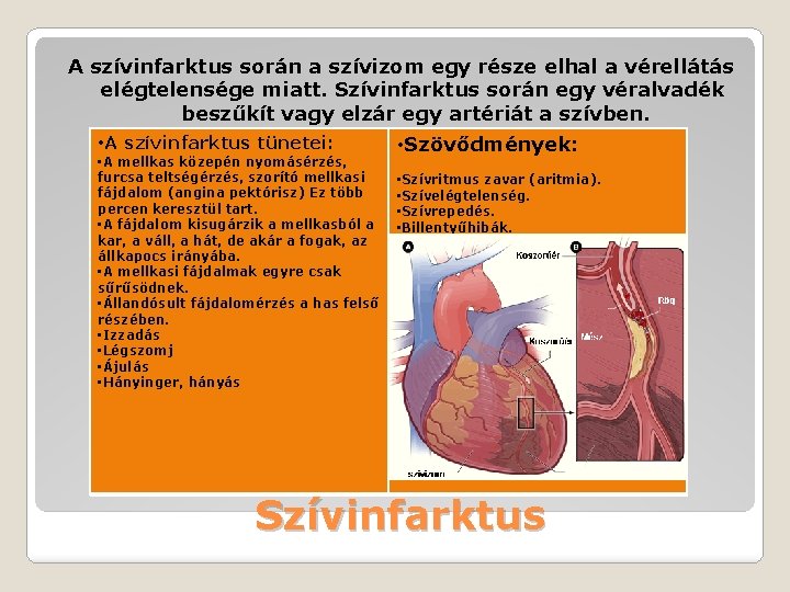 A szívinfarktus során a szívizom egy része elhal a vérellátás elégtelensége miatt. Szívinfarktus során